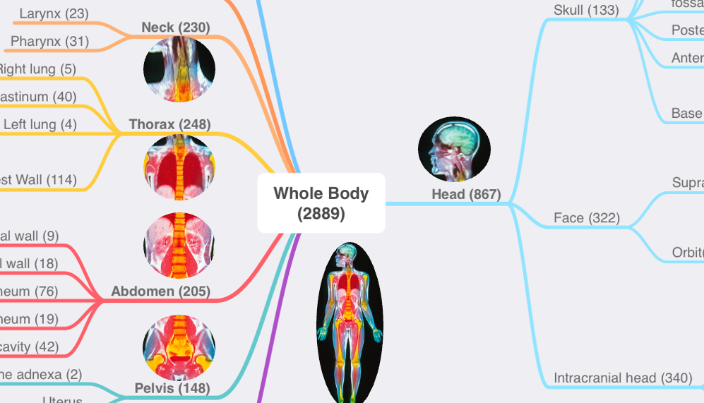 Tree of body part nodes organized according to a "contained-by" hierarchy